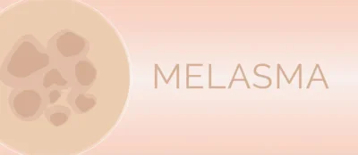 Melasma During Pregnancy